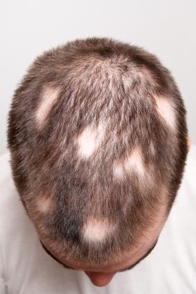 The hair on your head can be a defining part of your identity.