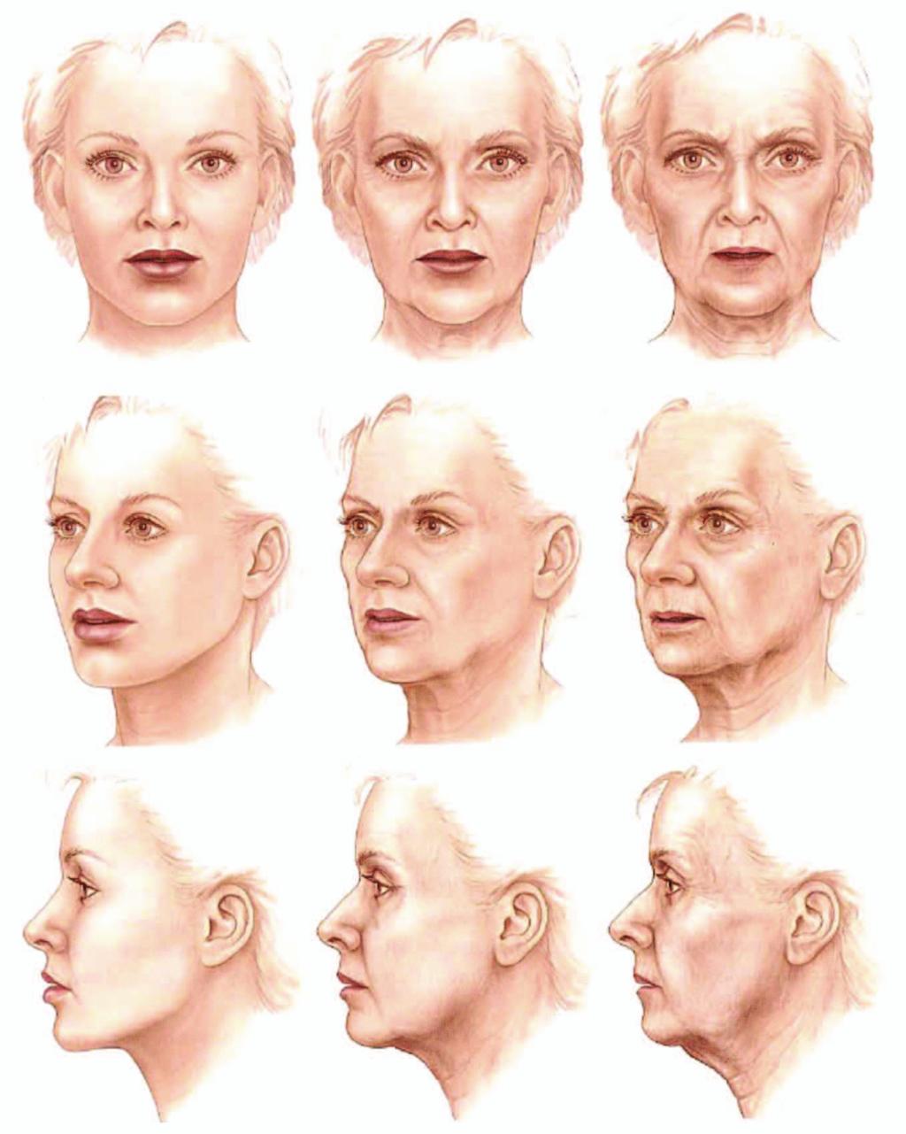 Figure 2. Aging of the female face, as represented by models representing an individual at ~20 years of age (left), ~50 years (center), and ~75 years (right).