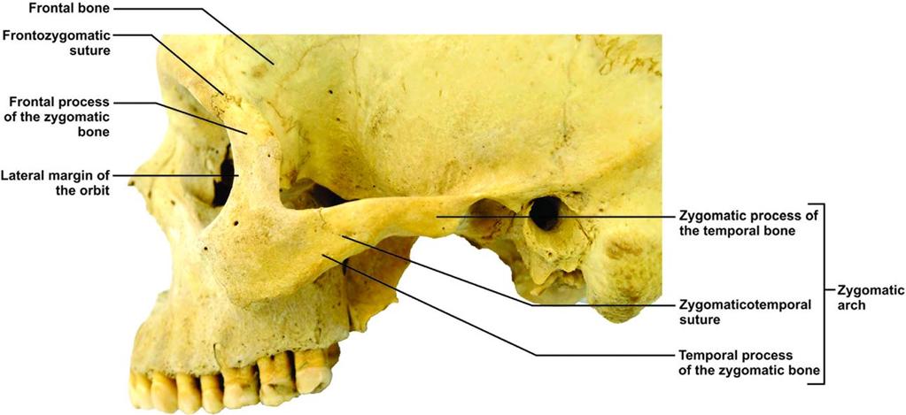 ANCESTRAL VARIATIONS OF THE ZYGOMA 197 Fig. 1. Bony landmarks on Skull in norma lateralis. diversifications of early groups have been made on the basis of shape and size variations of the zygoma.