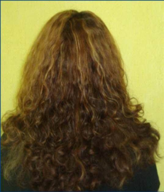 RESULTS Better anti-frizz allignment and
