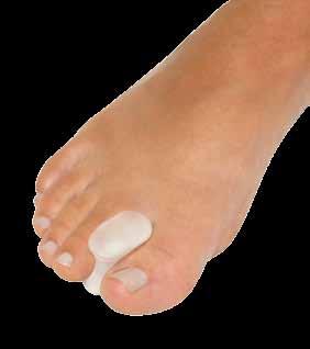 overlapping toes Separates toes to relieve pressure and friction Used as an