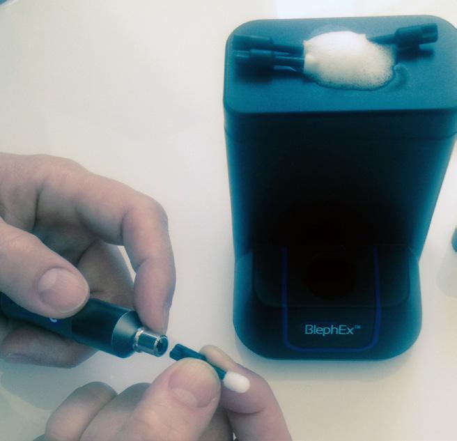 Press and hold the power button for two seconds to start the BlephEx device ( F LED will light