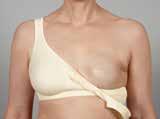 PurFit adjustable enhancer Ideal during reconstruction, when she needs a graceful transformation Purfit Style 333