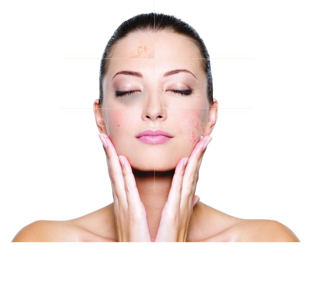 PROBLEM SKIN Help prevent acne & soothe irritation EYES Moisturize &
