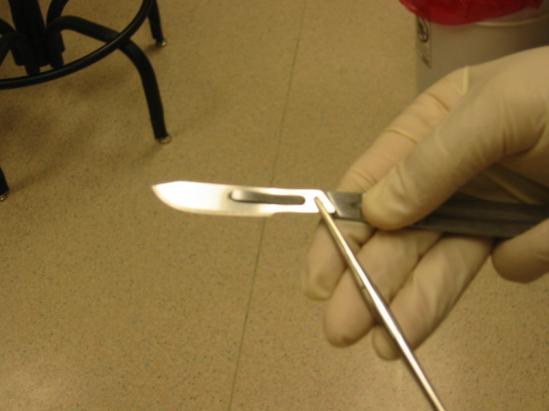 There are two methods for removing a dull scalpel blade from a handle.