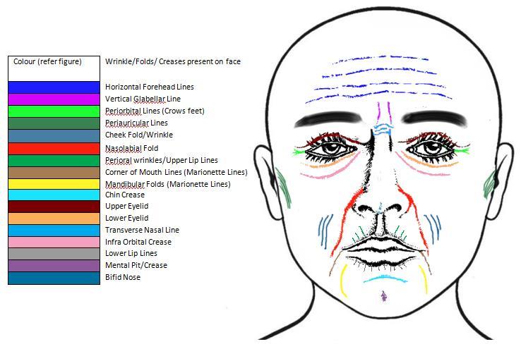 Figure 2 Common creases available on the face.