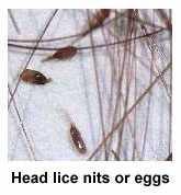 NITS Nits less than a 1/4 inch from the scalp indicate the presence an active head lice