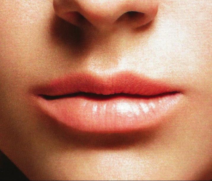Landmarks of Surface Lip Anatomy Cupids bow Depression between the base of the Philtral Columns