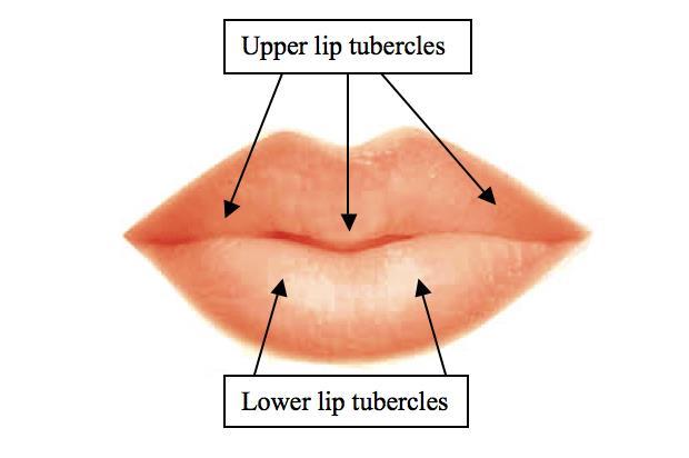 Landmarks of Surface Lip Anatomy
