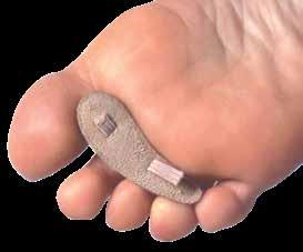 TOE MANAGEMENT Don t be fooled by imitations, insist on PediFix quality products Hammer Toe Crests Relieve Toe