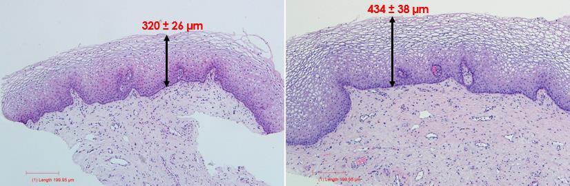 HISTOLOGY Before Treatment 3 mos Post 3 Treatments Figures showing increase in epithelial thickness 1-month after