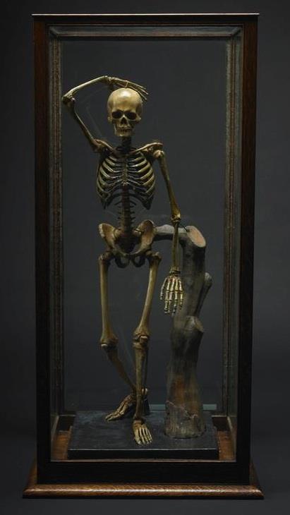 Joseph Towne the Wax Modeler 1826 Towne was awarded Silver Medal for his model of a skeleton, preserved at the Gordon Museum Appointed official Modeler of the Guy s