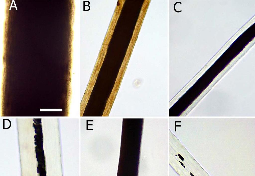 Figure 3: Morphology of the hair medulla in
