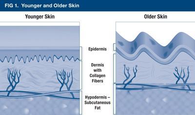 carotenoids was shown to decrease skin fold thickness and mast cell infiltration, seen with extended UV exposure.