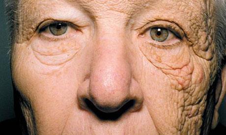 How UV Can Affect Outdoor Workers Example 3 Type of work: Lorry Driver Incident: Photoageing.