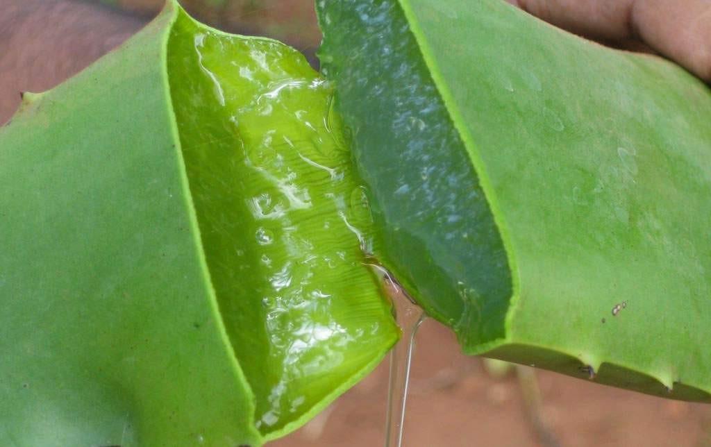 Aloe vera: this thick, gelatinous juice of the aloe vera plant can take the sting and redness out of a sunburn. Aloe vera causes blood vessels to constrict.