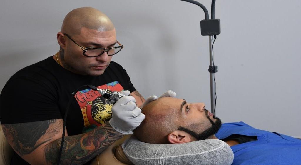Procedure By A Hair Tattoo Artist More Than A Tattoo Shop It is Hair Loss Restoration Your Alternative to Hair Loss Surgery 3,500 5