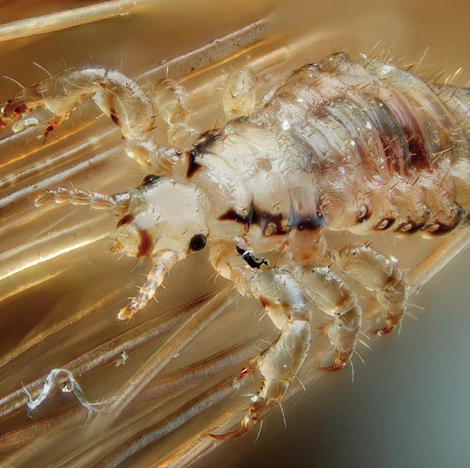 What a louse is? It s a parasite insect, 1 to 3 millimeters long, it has 3 pairs of legs provided with strong hooks which allow it to get attached firmly to the hair.