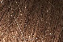 near the scalp 7 Transmission Lice do not hop or jump; only crawl Transmission by direct contact Indirect contact by personal items much less likely