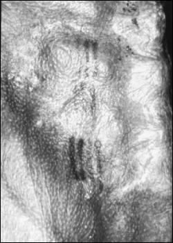 Tattoos Closer examination of Ötzi s remaining skin on the back and lower legs revealed distinctive intersecting lines of pigment that appear to have been tattoos.