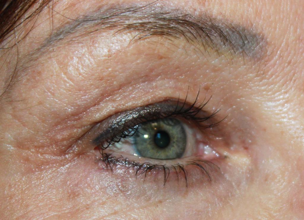 33 INTENSIVE EYE THERAPY (CONTINUED) Designed specifically to reinvigorate aging skin surrounding the eye.