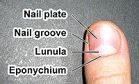You may have a nail fungal infection also called onychomycosis (on-i-ko-mi-ko-sis) if one or more of your nails are: Thickened Brittle, crumbly or ragged Distorted in shape Dull, with no luster or