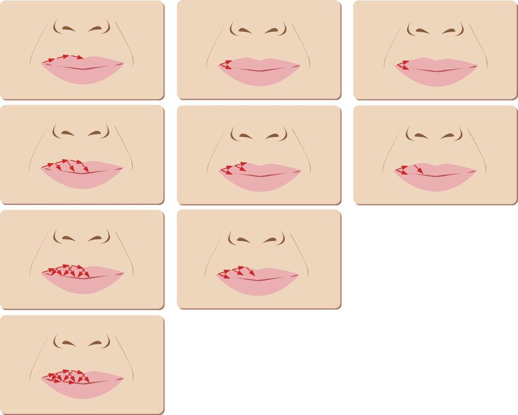 Correction of the lip form Hyalual 2,2% Product amount 1-2ml I I I I I