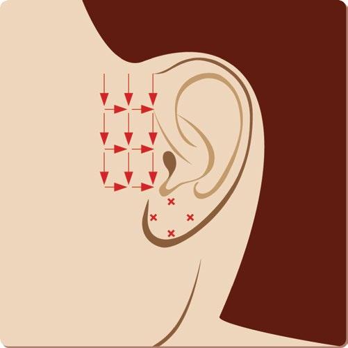 Redermalization of ears Hyalual 2,2% Product