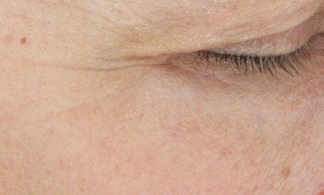 improvement in skin smoothness under the eye 96% showed improvement in the appearance of under-eye radiance Clinical study of 26 participants, % of participants improved vs.