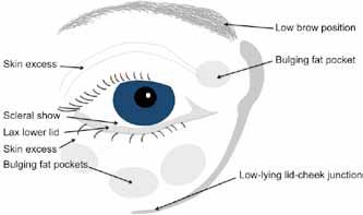 Figure above the ageing eye When considering the above, the importance of a careful clinical examination and analysis of your eyes can be appreciated, as everyone is affected by the above changes to