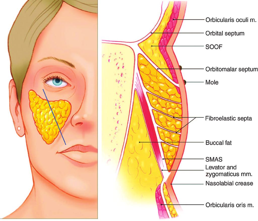in a curving arc defining the inferior margin of the infraorbital skin. Fig. 2.