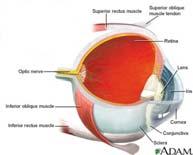 roof-floor floor of the orbit Blunt Trauma to Eye Smaller Objects Injury to eye structures Cornea, lens,