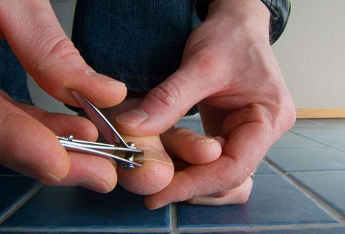 Toe nails should be properly trimmed to avoid discomfort