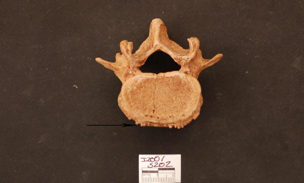 Figure 9: Individual 200 030 Osteophytosis