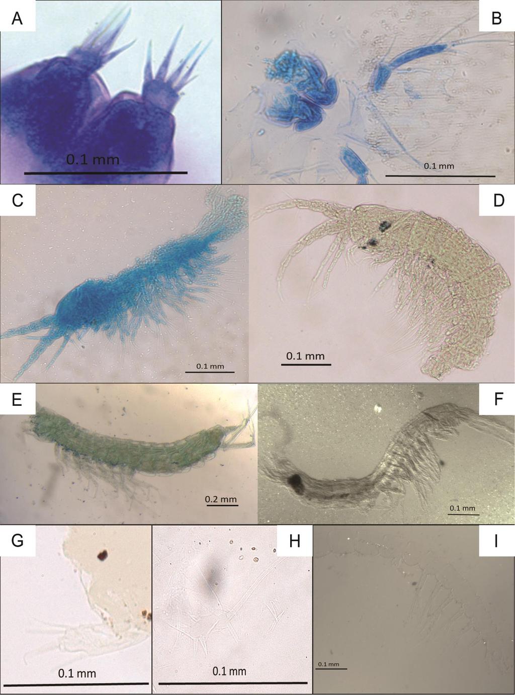 Figure 4. Images of Bathynellacea prepared with different methods. A-B-C: bathynellid furca, male thoracopod VIII and pleopod, half body in stained glycerine jelly (well impregnated tissues).