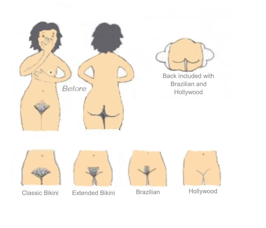 straight line (no hair will be removed from labia or buttock crease) Brazilian - 20 removing all the hair from the inner and outer labia and buttock crease (if requested) leaving a small strip on the
