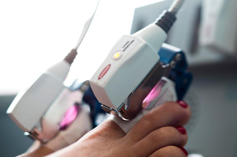 In Summary: Why Choose Laser? To recap, laser treatment offers many significant advantages over traditional oral antifungal treatments, with few if any medical disadvantages. It s faster.