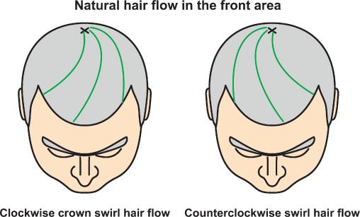 ORIENTATION OF HAIR FOLLICLES Figure 8. Natural hair flow in the front area.