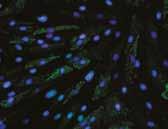 Treatment with inhibits the expression of anchoring proteins (VCAM-1 in green, nuclei in blue (DAPI)) at the surface of endothelial cells.
