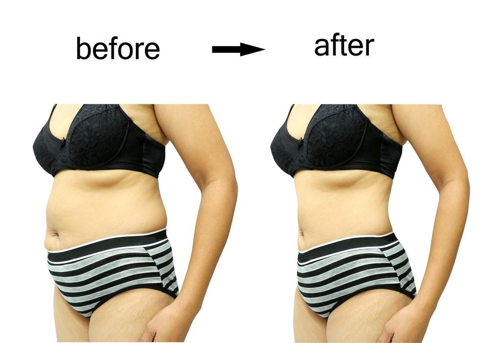 Unwanted Body Fat Concerns Muffin Top, Bra Fat, Love Handles, Saddle Bags, Banana Roll Solutions can include: Lipodissolve $180.00 $5.400.00 Body Skin Care Regimen +$120.