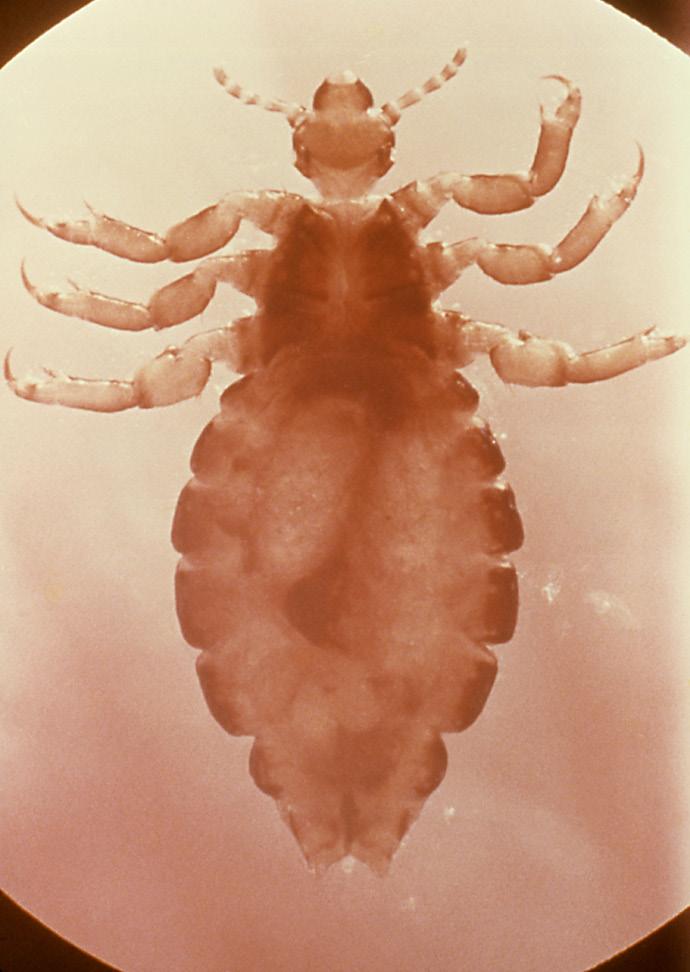 Human Lice E-245-W 2 being about 1/8 inch long, cylindrical, and grayish-white when unfed. Adults of the pubic louse (Fig.