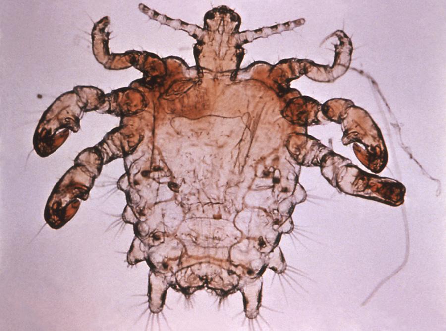 Immature human lice are known either as larvae or nymphs, and they resemble the corresponding adults, but they are smaller and paler in color.