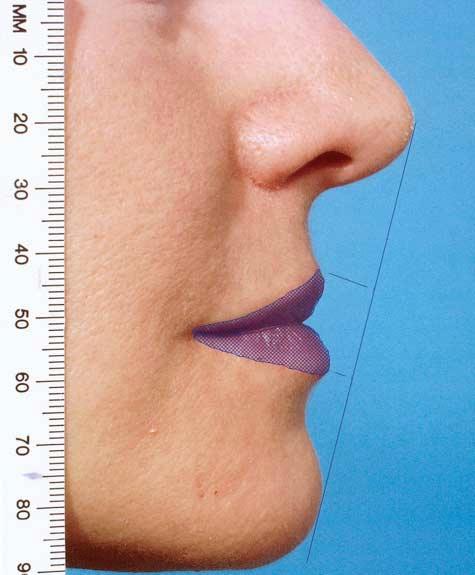 upper red lip length; (6) upper red lip area; and (7) lower red lip area. Units on the ruler are millimeters.