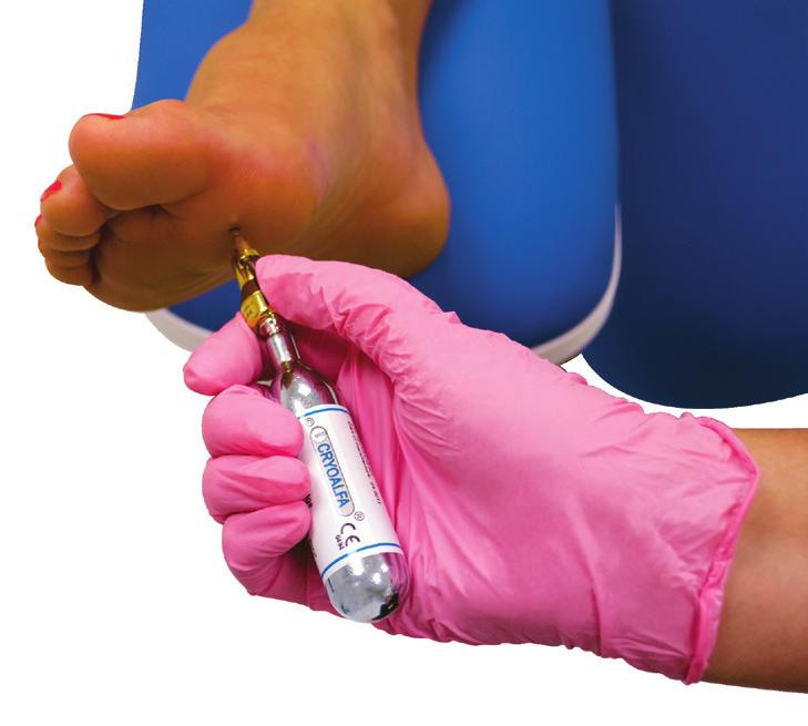 Cryoalfa S Cryoalfa S is a highly effective and accurate handheld cryosurgery unit complete with gas cartridge and instructions.