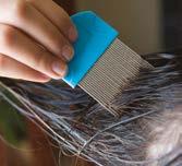 Detection Head lice can t be prevented but regular checking ensures early detection and treatment if necessary. The best detection method is wet combing (see page 5).