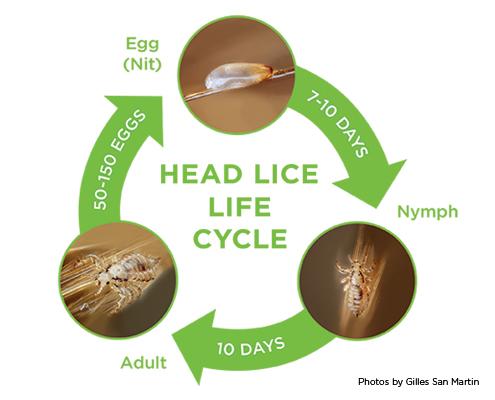 Head Lice Symptoms Head Lice are most commonly fond on the scalp, behind the ears and near the neckline at the base of the head.