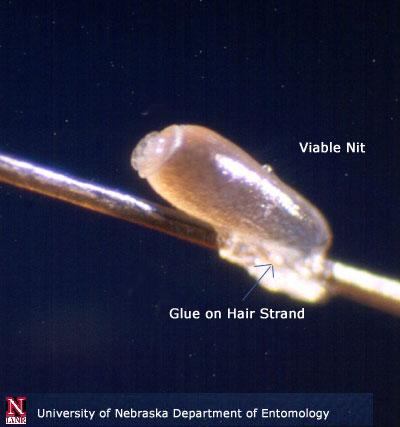 KNOW YOUR NITS Female lice attach eggs ( nits ) to the shaft of the hair near the scalp.