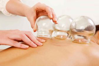 CUPPING THERAPY Did the recent Olympic Games spark your interest? Were you wondering what those dark circles were on the backs of Michael Phelps and other athletes?