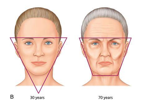 THE AGEING FACE Over many years the changes in skin laxity lead to loss of the volume and curves of the
