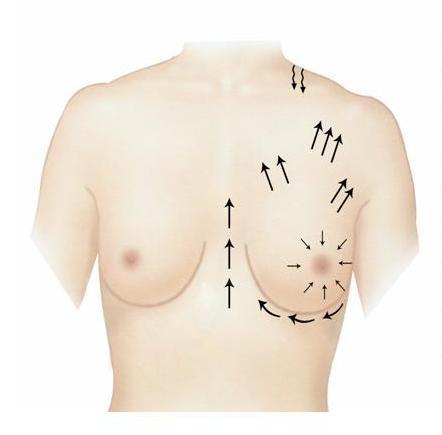 Breast Enlargement Inject the suture in direction towards nipple and massage the breast more than twice a day.